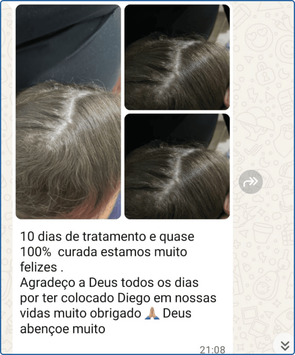 Depoimento Kit Scalp Care 2